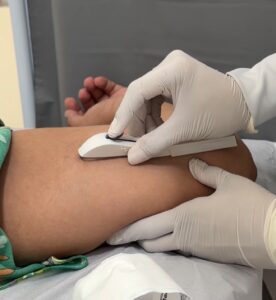Coren-PI inicia fase prática da capacitação de Enfermeiros para a inserção de DIU e Implanon